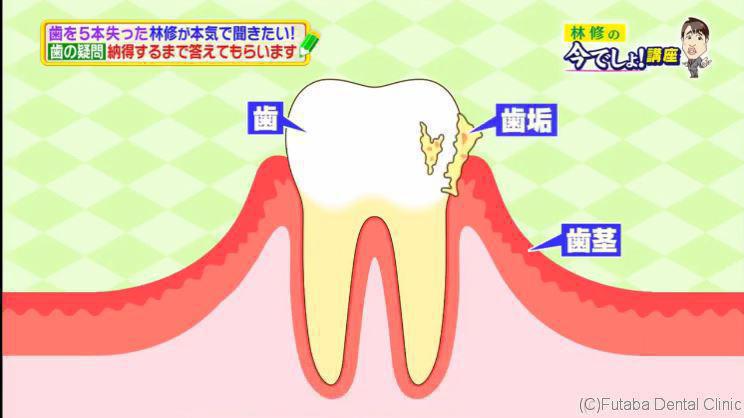 林修の今でしょ!講座 - 16.02.09 - 日本综艺 - MioMio弹幕网 - ( ^ω^)你是我的Master吗 - miomio.tv.mp4_002138791